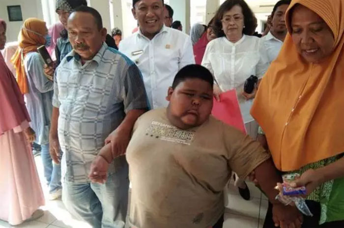 Sebelum Meninggal karena Sesak Nafas, Satia Bocah Obesitas Bilang ke Ayah: Pak, Saya Sudah Tidak Kuat...