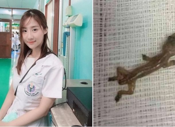 Ngeri! Dokter Cantik Ini Kaget Lihat Cicak Merayap di Dalam Telinga Pasiennya
