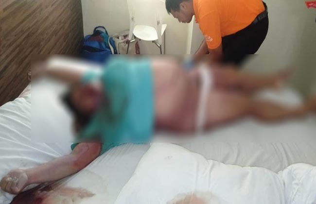 SEDIH...Berencana Menikah Bulan Depan, Wanita Muda Ini Malah Tewas Membengkak di Kamar Penginapan