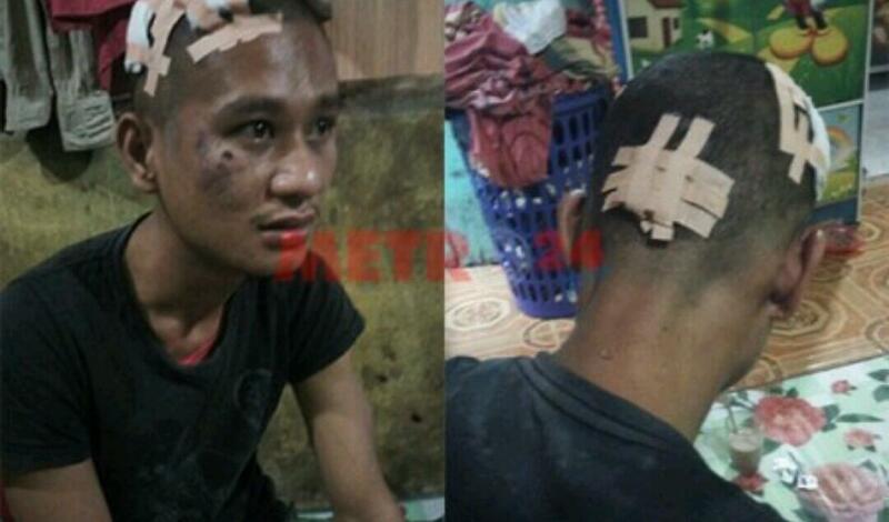 KEJAMNYA...Fadli Babak Belur Usai Dikeroyok 12 Orang, Diikat ke Tiang Listrik dan Ditelanjangi, Diseret Pakai Motor 