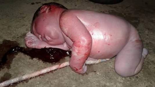 BENAR_BENAR SADIS... Bayi Merah Dibuang di Pinggir Jalan Ini Jadi Tontonan Memilukan di Medsos