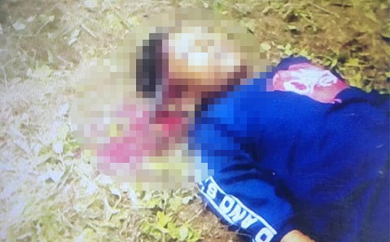 Remaja 14 Tahun Tewas dengan Pisau Potong Rumput Nancap di Kepala