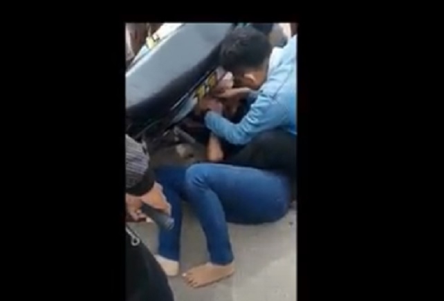 Mengerikan! Gamis Tersangkut Roda Motor, Tangan Wanita Ini Patah Tiga dan Dua Jari Remuk