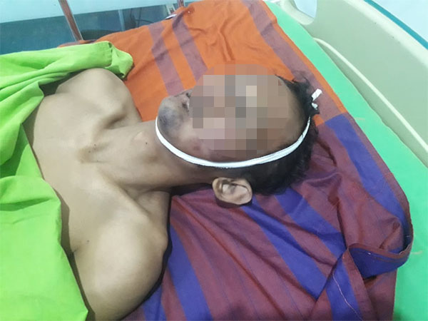 Iseng Remas Payudara Cewek Cantik, Pria 26 Tahun Ini Tewas Dikeroyok Keluarga Korban