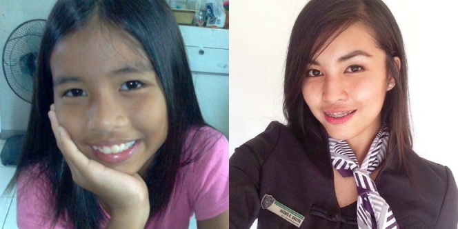 OMG.. Transformasi Wajah Gadis Ini Bikin Takjub Netizen, Lihat Fotonya