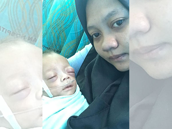 Biaya Rumah Sakit Rp300 Juta, Bayi TKW Asal Indonesia Tertahan di Malaysia, Nurul Minta Tolong Bupati, Gubernur dan Presiden Jokowi 