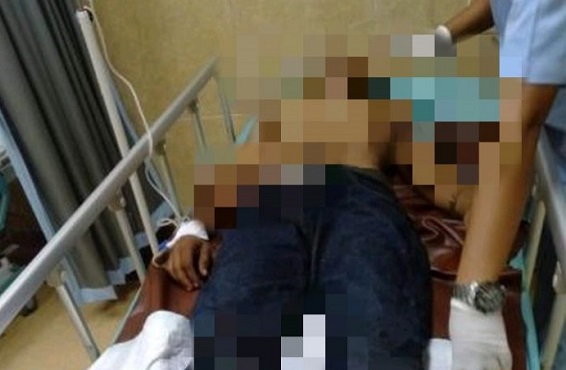 Dua Pelaku Perampokan Toko Gina Jaya di Duri Ditangkap, Seorang Tumbang Ditembak Polisi