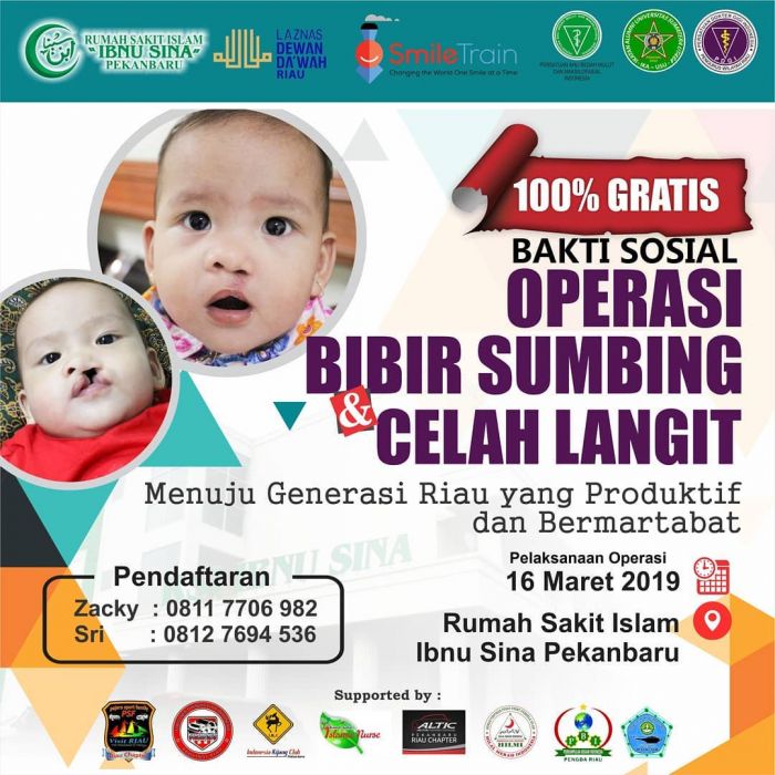 Gratis, RSI Ibnu Sina Gelar Operasi Bibir Sumbing dan Celah Langit
