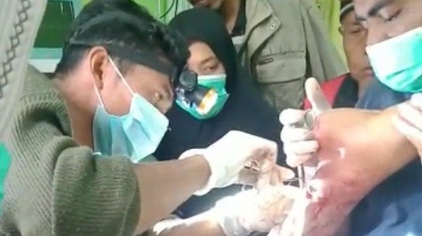 Dililit dan Digigit Piton Besar, Meri Selamat dengan Tendon Putus dan Kaki Luka Parah Setelah Lakukan...