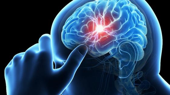 WASPADA!  7 Keluhan Ini Bisa Menjadi Tanda Anda Mengalami Stroke Ringan